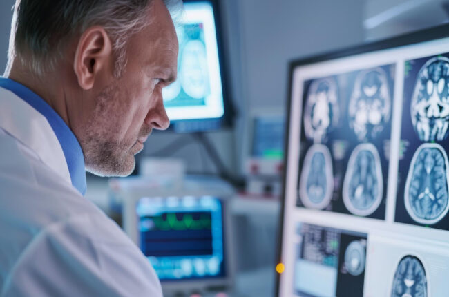 crisis epilepsia